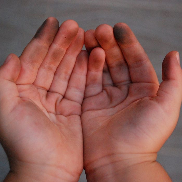 Dirty hands